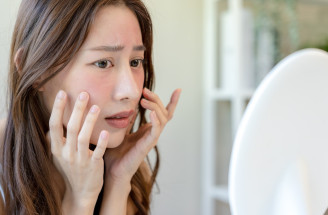 Beauty poradňa GERnétic: Upokojenie citlivej pleti