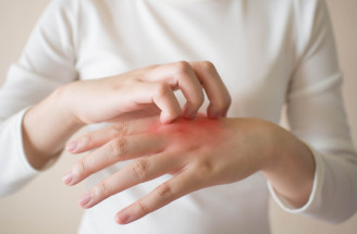 Beauty poradňa GERnétic: Ako si poradiť so suchou a svrbiacou pokožkou